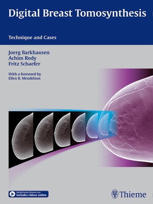 cover image of Digital Breast Tomosynthesis